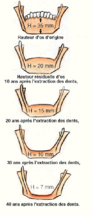 lifting tunisie, lifting mammaire tunisie, Chirurgie tunisie, lipofilling tunisie, clinique tunisie, esthétique tunisie, chirurgie mammaire tunisie, liposuccion tunisie, rhinoplastie tunisie, augmentation mammaire tunisie, chirurgie pas cher, chirurgie homme tunisie