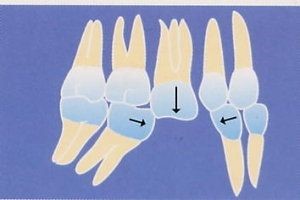 Implantologie dentaire 3 esthétique tunisie, clinique tunisie, abdominoplastie tunisie, rhinoplastie tunisie, chirurgie pas cher, liposuccion tunisie, opération tunisie, lifting tunisie, chirurgie esthétique tunisie, chirurgie homme tunisie, lipofilling tunisie, augmentation mammaire tunisie