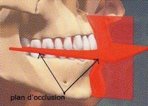 Implantologie dentaire 4 esthétique tunisie, clinique tunisie, abdominoplastie tunisie, rhinoplastie tunisie, chirurgie pas cher, liposuccion tunisie, opération tunisie, lifting tunisie, chirurgie esthétique tunisie, chirurgie homme tunisie, lipofilling tunisie, augmentation mammaire tunisie