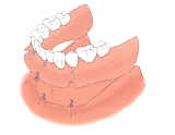 Chirurgie tunisie, lifting mammaire tunisie, rhinoplastie tunisie, augmentation mammaire tunisie, esthétique tunisie, lifting tunisie, chirurgie pas cher, lipofilling tunisie, liposuccion tunisie, chirurgie homme tunisie, chirurgie mammaire tunisie, chirurgie esthétique tunisie