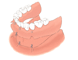 chirurgie esthétique tunisie, clinique tunisie, liposuccion tunisie, Chirurgie tunisie, rhinoplastie tunisie, opération tunisie, lipofilling tunisie, augmentation mammaire tunisie, abdominoplastie tunisie, esthétique tunisie, chirurgie pas cher, chirurgie homme tunisie