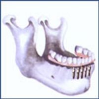 Chirurgie tunisie, lifting mammaire tunisie, rhinoplastie tunisie, augmentation mammaire tunisie, esthétique tunisie, lifting tunisie, chirurgie pas cher, lipofilling tunisie, liposuccion tunisie, chirurgie homme tunisie, chirurgie mammaire tunisie, chirurgie esthétique tunisie