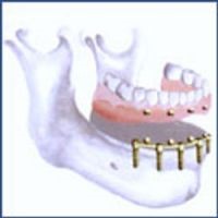 Chirurgie tunisie, lifting mammaire tunisie, rhinoplastie tunisie, augmentation mammaire tunisie, esthétique tunisie, lifting tunisie, chirurgie pas cher, lipofilling tunisie, liposuccion tunisie, chirurgie homme tunisie, chirurgie mammaire tunisie, chirurgie esthétique tunisie