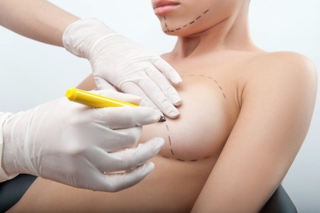 Lifting mammaire 1 esthétique tunisie, clinique tunisie, rhinoplastie tunisie, liposuccion tunisie, chirurgie homme tunisie, lipofilling tunisie, Chirurgie tunisie, augmentation mammaire tunisie, chirurgie mammaire tunisie, abdominoplastie tunisie, opération tunisie, chirurgie esthétique tunisie