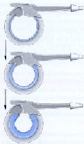 L’anneau gastrique 4 chirurgie pas cher, rhinoplastie tunisie, chirurgie mammaire tunisie, esthétique tunisie, lifting mammaire tunisie, clinique tunisie, liposuccion tunisie, augmentation mammaire tunisie, chirurgie esthétique tunisie, lifting tunisie, abdominoplastie tunisie