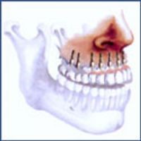 chirurgie mammaire tunisie, lipofilling tunisie, chirurgie homme tunisie, augmentation mammaire tunisie, liposuccion tunisie, rhinoplastie tunisie, Chirurgie tunisie, opération tunisie, lifting tunisie, chirurgie pas cher, clinique tunisie, abdominoplastie tunisie