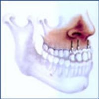 chirurgie mammaire tunisie, lipofilling tunisie, chirurgie homme tunisie, augmentation mammaire tunisie, liposuccion tunisie, rhinoplastie tunisie, Chirurgie tunisie, opération tunisie, lifting tunisie, chirurgie pas cher, clinique tunisie, abdominoplastie tunisie