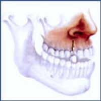chirurgie mammaire tunisie, lipofilling tunisie, chirurgie homme tunisie, augmentation mammaire tunisie, liposuccion tunisie, rhinoplastie tunisie, Chirurgie tunisie, opération tunisie, lifting tunisie, chirurgie pas cher, clinique tunisie, abdominoplastie tunisie