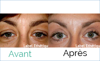 Chirurgie tunisie, lifting mammaire tunisie, opération tunisie, lipofilling tunisie, chirurgie esthétique tunisie, abdominoplastie tunisie, chirurgie pas cher, chirurgie mammaire tunisie, chirurgie homme tunisie, esthétique tunisie, liposuccion tunisie, clinique tunisie