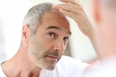 Greffes de cheveux 1 abdominoplastie tunisie, clinique tunisie, chirurgie pas cher, chirurgie mammaire tunisie, opération tunisie, liposuccion tunisie, Chirurgie tunisie, chirurgie homme tunisie, lipofilling tunisie, lifting mammaire tunisie, esthétique tunisie, lifting tunisie