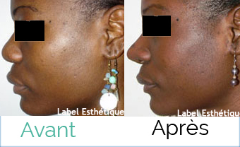 augmentation mammaire tunisie, rhinoplastie tunisie, esthétique tunisie, lifting mammaire tunisie, clinique tunisie, Chirurgie tunisie, lifting tunisie, chirurgie pas cher, lipofilling tunisie, liposuccion tunisie, chirurgie homme tunisie, chirurgie mammaire tunisie