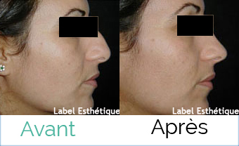 augmentation mammaire tunisie, rhinoplastie tunisie, esthétique tunisie, lifting mammaire tunisie, clinique tunisie, Chirurgie tunisie, lifting tunisie, chirurgie pas cher, lipofilling tunisie, liposuccion tunisie, chirurgie homme tunisie, chirurgie mammaire tunisie