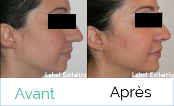 augmentation mammaire tunisie, rhinoplastie tunisie, esthétique tunisie, lifting mammaire tunisie, clinique tunisie, Chirurgie tunisie, lifting tunisie, chirurgie pas cher, lipofilling tunisie, liposuccion tunisie, chirurgie homme tunisie, chirurgie mammaire tunisie