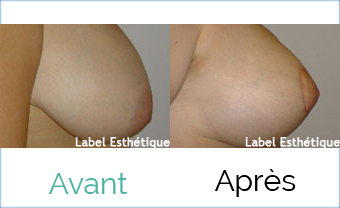 Chirurgie tunisie, esthétique tunisie, clinique tunisie, lifting tunisie, opération tunisie, chirurgie esthétique tunisie, chirurgie pas cher, lifting mammaire tunisie, rhinoplastie tunisie, liposuccion tunisie, chirurgie mammaire tunisie, lipofilling tunisie