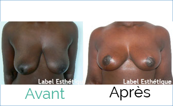 clinique tunisie, opération tunisie, chirurgie homme tunisie, esthétique tunisie, chirurgie pas cher, lipofilling tunisie, chirurgie mammaire tunisie, chirurgie esthétique tunisie, lifting mammaire tunisie, liposuccion tunisie, lifting tunisie, rhinoplastie tunisie