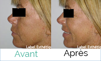 Chirurgie tunisie, clinique tunisie, chirurgie pas cher, esthétique tunisie, lifting tunisie, liposuccion tunisie, chirurgie homme tunisie, lipofilling tunisie, augmentation mammaire tunisie, chirurgie mammaire tunisie, rhinoplastie tunisie, abdominoplastie tunisie