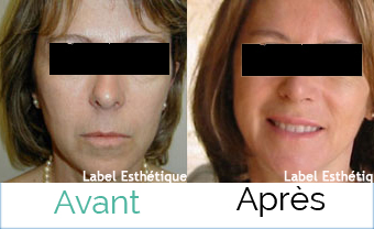 clinique tunisie, chirurgie homme tunisie, esthétique tunisie, rhinoplastie tunisie, lifting mammaire tunisie, Chirurgie tunisie, chirurgie mammaire tunisie, abdominoplastie tunisie, lifting tunisie, opération tunisie, liposuccion tunisie, chirurgie esthétique tunisie