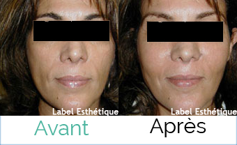 clinique tunisie, chirurgie homme tunisie, esthétique tunisie, rhinoplastie tunisie, lifting mammaire tunisie, Chirurgie tunisie, chirurgie mammaire tunisie, abdominoplastie tunisie, lifting tunisie, opération tunisie, liposuccion tunisie, chirurgie esthétique tunisie