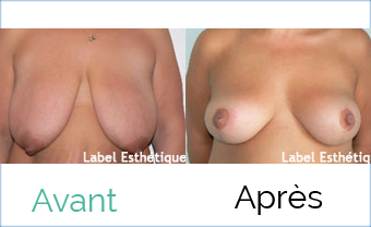 esthétique tunisie, lifting tunisie, clinique tunisie, liposuccion tunisie, abdominoplastie tunisie, chirurgie homme tunisie, opération tunisie, chirurgie pas cher, lipofilling tunisie, augmentation mammaire tunisie, chirurgie mammaire tunisie, chirurgie esthétique tunisie