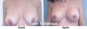 liposuccion tunisie, opération tunisie, abdominoplastie tunisie, chirurgie mammaire tunisie, chirurgie homme tunisie, chirurgie pas cher, lifting tunisie, chirurgie esthétique tunisie, augmentation mammaire tunisie, esthétique tunisie, Chirurgie tunisie