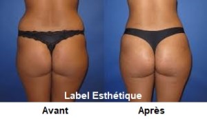 lifting tunisie, abdominoplastie tunisie, lipofilling tunisie, liposuccion tunisie, chirurgie mammaire tunisie, augmentation mammaire tunisie, rhinoplastie tunisie, clinique tunisie, lifting mammaire tunisie, opération tunisie, chirurgie esthétique tunisie